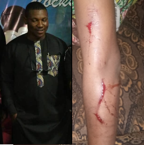 They are my sisters, I only flogged them with belt,I have every right to discipline them” NSCDC official allegedly